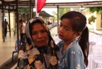Puluhan Anak Jalani Operasi Bibir Sumbing dan Khitan Gratis di RS Bhayangkara Banda Aceh