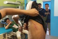 Seorang Pemuda Asal Simeulue Jadi Korban Pembacokan Kerusuhan Remaja di Banda Aceh