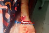 Tangan Hampir Putus, Begal Semangkin Di Depan Tanpa Ampun Incar Mangsanya. Begini Kata Polisi!