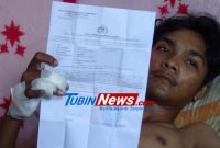 Kesaksian Ari Prayoga Korban Begal Bersenpi Sadis Tanpa Ampun Di Jalan Lintas Kualanamu