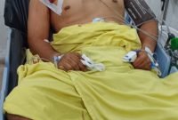 Anggota Polisi Ditembak Saat Penangkapan di Medan Tembung, Begini Kata Kapolda
