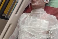 Polres Pelabuhan Belawan Ungkap Kronologi Pembakaran Ayah Kandung