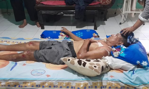 Kawanan Begal Beraksi di Jalan Sutrisno Medan, Seorang Loper Koran Terluka