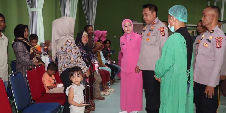 Wujud Kepedulian di Hari Bhayangkara ke-79, Polres Aceh Barat Gelar Bakti Sosial Operasi Bibir Sumbing