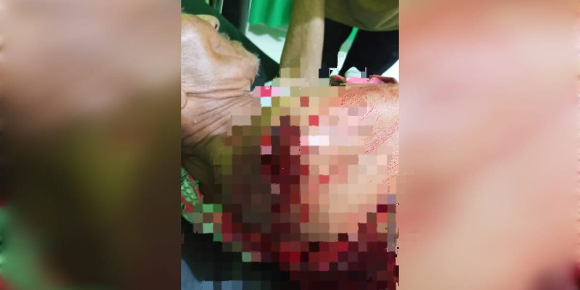 Pria di Simeulue Barat Bacok Tiga Warga, Diduga Alami Gangguan Pikiran