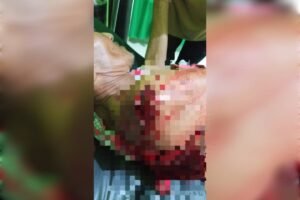 Pria di Simeulue Barat Bacok Tiga Warga, Diduga Alami Gangguan Pikiran