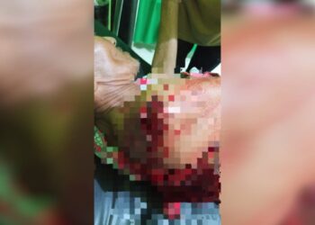 Pria di Simeulue Barat Bacok Tiga Warga, Diduga Alami Gangguan Pikiran