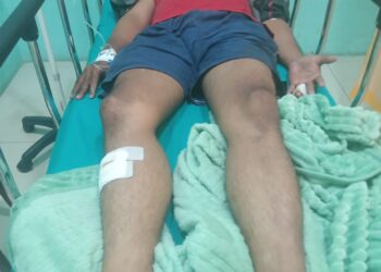 Driver Ojol Dibacok Kawanan Begal di Jalan Bandara Kualanamu 