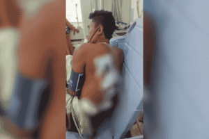 Warga Medan Nyaris Tewas Dibacok Begal saat Peringatan HUT RI ke-80