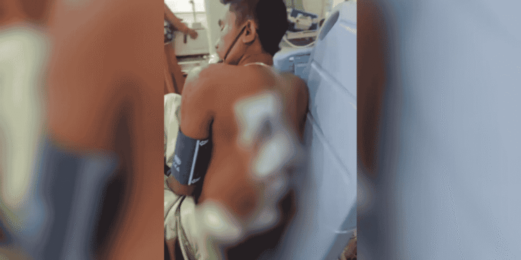 Warga Medan Nyaris Tewas Dibacok Begal saat Peringatan HUT RI ke-80