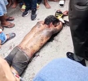 Tragis! Diduga Alami Gangguan Jiwa, Pria Nekat Tikam Perut dan Leher