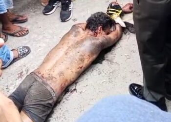 Tragis! Diduga Alami Gangguan Jiwa, Pria Nekat Tikam Perut dan Leher