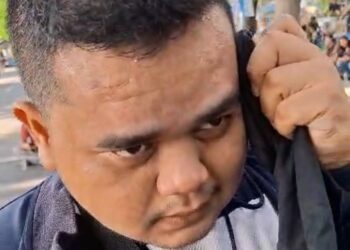 Jurnalis Posmetro Diduga Diculik dan Dianiaya Aparat Liputan Aksi Demo