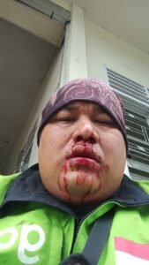 Ojol Diduga Jadi Korban Penganiayaan Oknum Dosen STIPAP