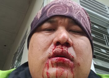 Ojol Diduga Jadi Korban Penganiayaan Oknum Dosen STIPAP