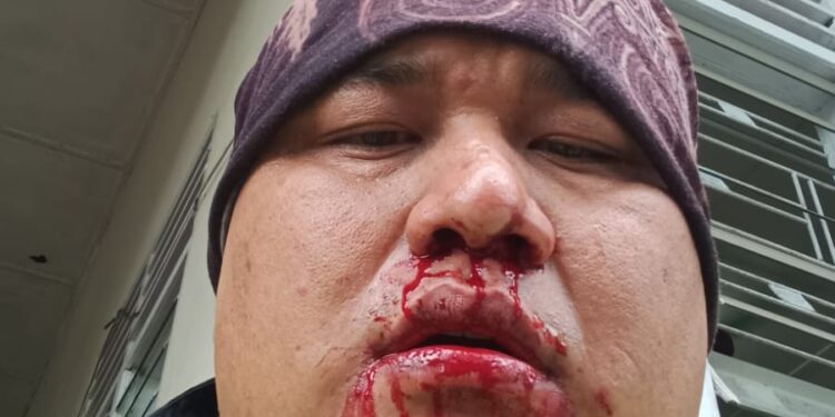 Ojol Diduga Jadi Korban Penganiayaan Oknum Dosen STIPAP