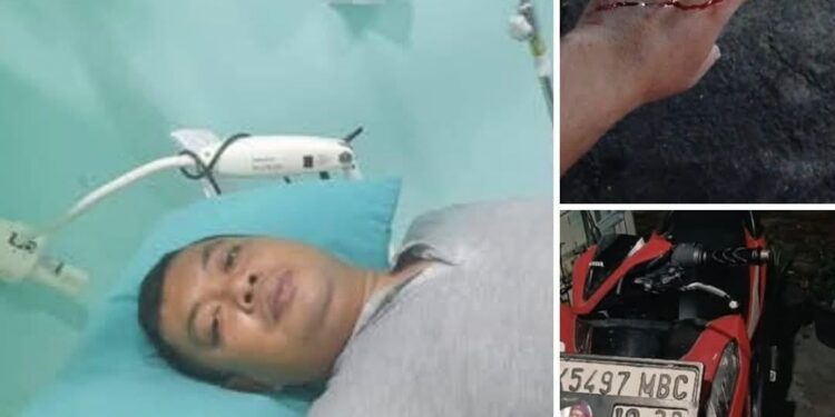 Kapolda Sumut Diminta Lebih Semangat Berantas Begal