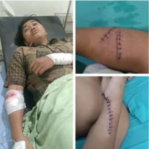 Muhammad Daffa Jadi Korban Begal Sadis AKP Ras Maju Tarigan: Segera di Rilis
