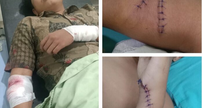 Muhammad Daffa Jadi Korban Begal Sadis AKP Ras Maju Tarigan: Segera di Rilis