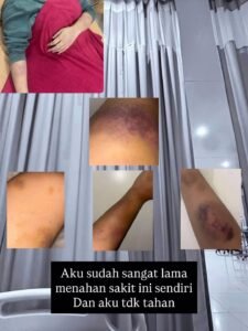 Diduga Dianiaya Oleh Kekasih Oknum Brimob Korban Berharap Pelaku Ditangkap