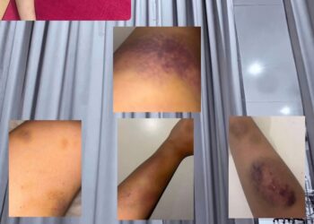 Diduga Dianiaya Oleh Kekasih Oknum Brimob Korban Berharap Pelaku Ditangkap