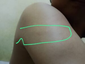 IMG-20251108-WA0042-300x225 Ojol Jadi Korban Begal, Motor dan HP Raib, Korban Alami Luka Akibat Tebasan Parang