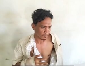 Warga Belawan Dibacok Lima OTK di Depan Pos Polisi, Kedua Tangan Korban Nyaris Putus