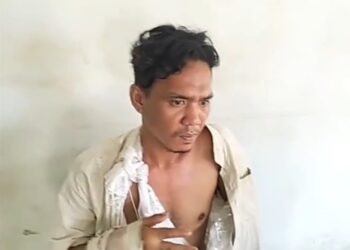 Warga Belawan Dibacok Lima OTK di Depan Pos Polisi, Kedua Tangan Korban Nyaris Putus