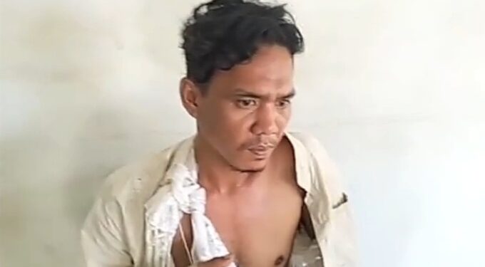 Warga Belawan Dibacok Lima OTK di Depan Pos Polisi, Kedua Tangan Korban Nyaris Putus