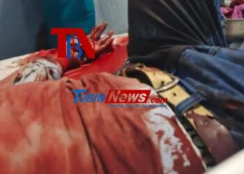 Tawuran Maut di Bagan Belawan, Seorang Pria Nyaris Kehilangan Tangan Akibat Bacokan