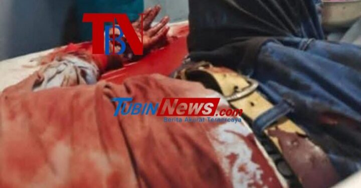 Tawuran Maut di Bagan Belawan, Seorang Pria Nyaris Kehilangan Tangan Akibat Bacokan