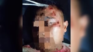 Pelaku Pemukulan Belum Ditahan, Keluarga Korban Pertanyakan Proses Hukum