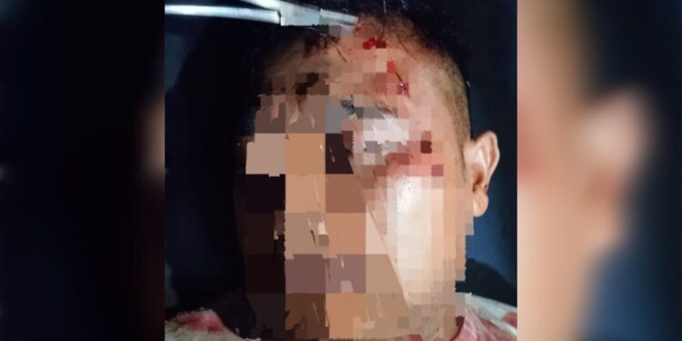 Pelaku Pemukulan Belum Ditahan, Keluarga Korban Pertanyakan Proses Hukum