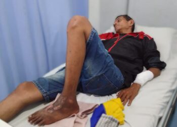 Tangan Patah Diduga Dipukul Abang Kandung Malah Mengaku Jadi Korban