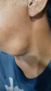 Screenshot_20260201_133523_WhatsApp-169x300 Niat Berobat Gratis Kandas, Warga Desa Cinta Rakyat Dikejutkan “Patok Harga” Rp600 Ribu