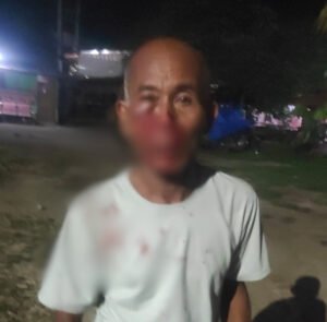Tersangka Pengeroyokan Masih Bebas, Polres Pematang Siantar Jangan Main Mata