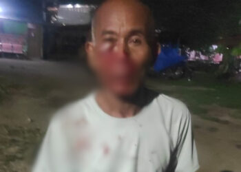 Tersangka Pengeroyokan Masih Bebas, Polres Pematang Siantar Jangan Main Mata