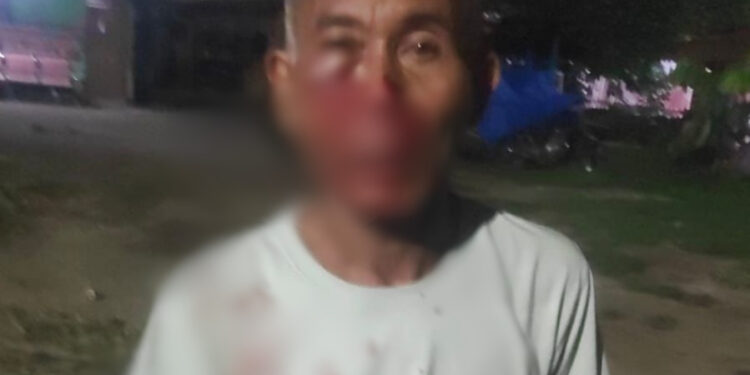 Tersangka Pengeroyokan Masih Bebas, Polres Pematang Siantar Jangan Main Mata