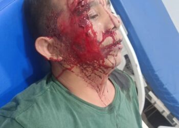 Begal Kembali Beraksi di Ring Road, Korban Alami Luka Bacok di Wajah