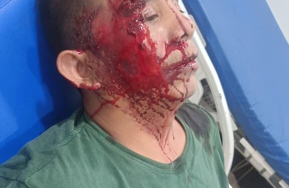 Begal Kembali Beraksi di Ring Road, Korban Alami Luka Bacok di Wajah