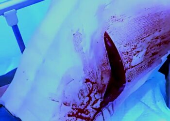 Kota Medan Kembali Marak Begal, Warga Pilih Jadi Korban Apa Melawan Pak Kapolrestabes Medan