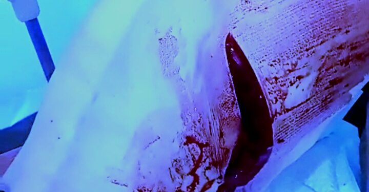 Kota Medan Kembali Marak Begal, Warga Pilih Jadi Korban Apa Melawan Pak Kapolrestabes Medan