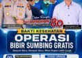 Polres Nagan Gelar Operasi Bibir Sumbing Gratis Berkolaborasi Dengan Kordinator Bibir Sumbing Rahmad Maulizar