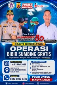 Hut Bhayangkara Polres Nagan Raya Gelar Operasi Bibir Sumbing Gratis