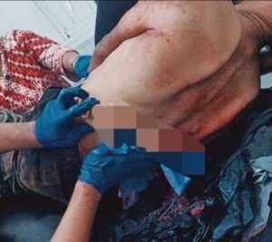 Aksi Brutal Puluhan Geng Motor Bersajam di Tanjung Merawa, Polisi Kejar Pelaku