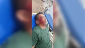 Begal Kembali Beraksi di Ring Road, Korban Alami Luka Bacok di Wajah