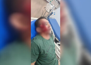 Begal Kembali Beraksi di Ring Road, Korban Alami Luka Bacok di Wajah