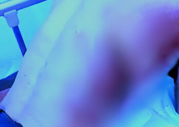 Kota Medan Kembali Marak Begal, Warga Pilih Jadi Korban Apa Melawan Pak Kapolrestabes Medan