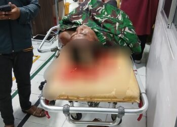 Mencekam!!! Adik Anggota TNI di Bacok Sejumlah Pria di Kawasan Jermal Kota Medan