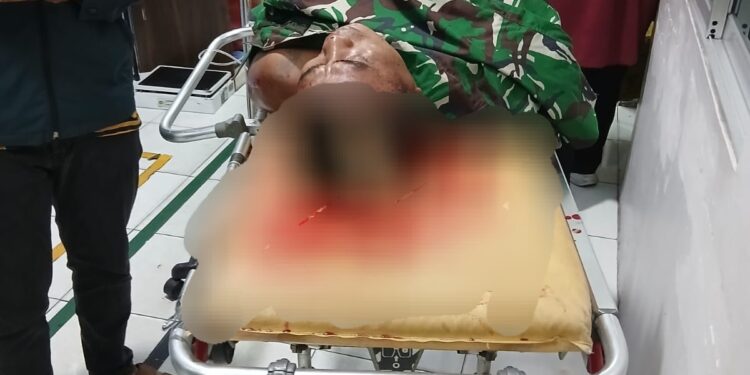 Mencekam!!! Adik Anggota TNI di Bacok Sejumlah Pria di Kawasan Jermal Kota Medan